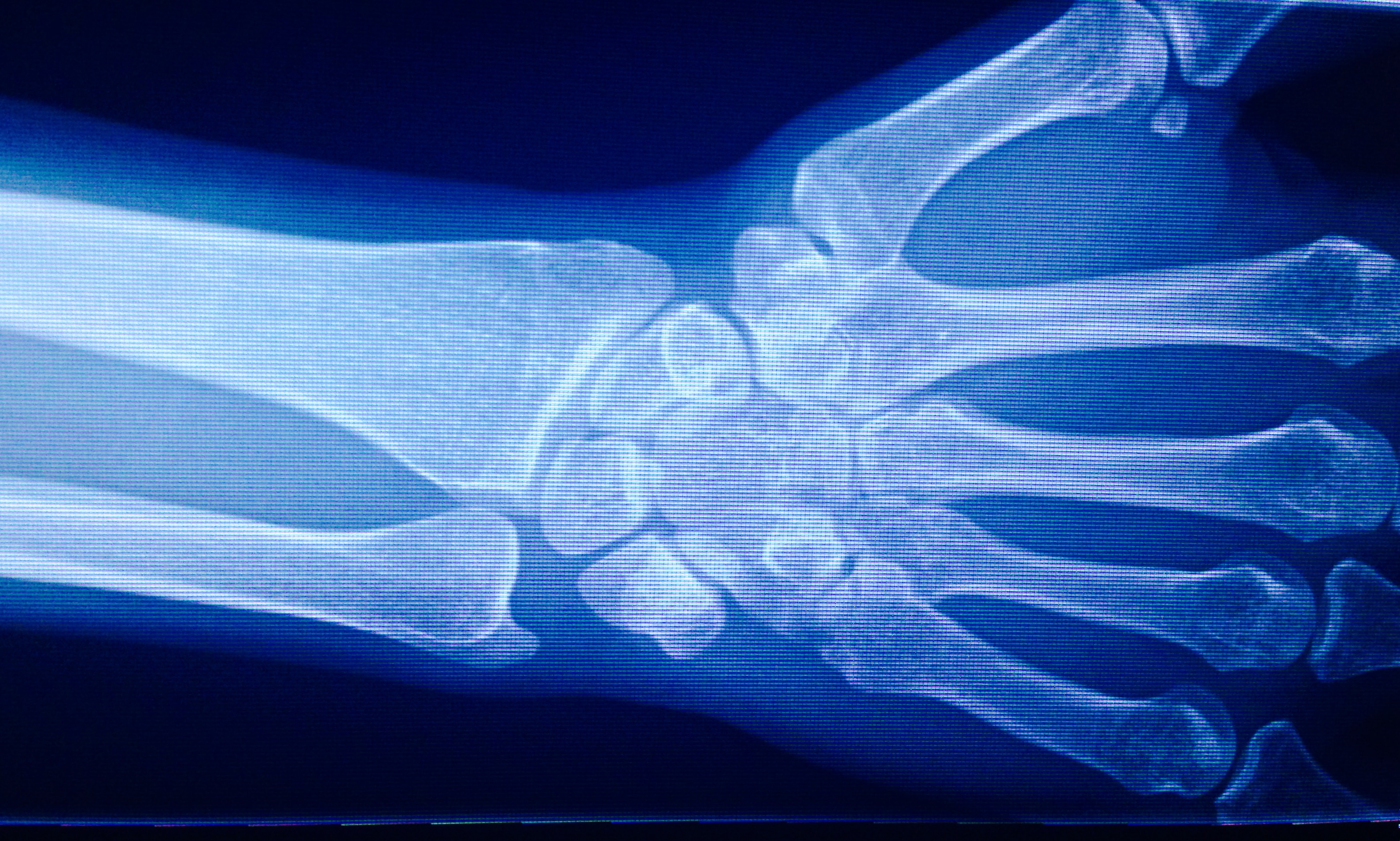 Success reversing autoimmune disease undervalued